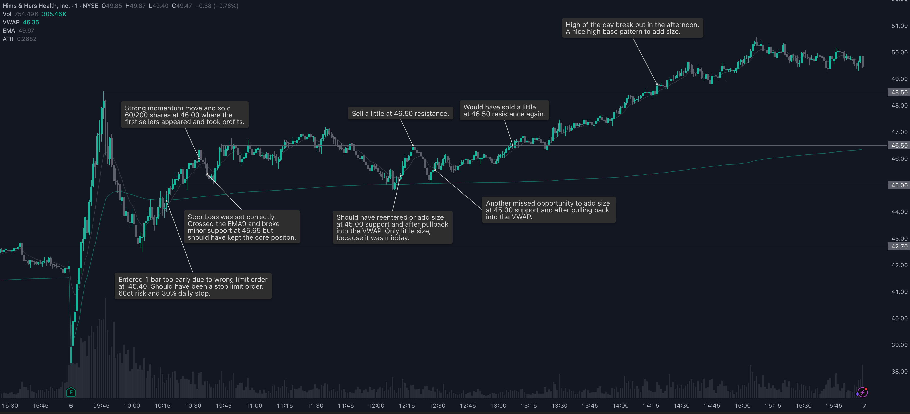 Trade Management 1M Chart